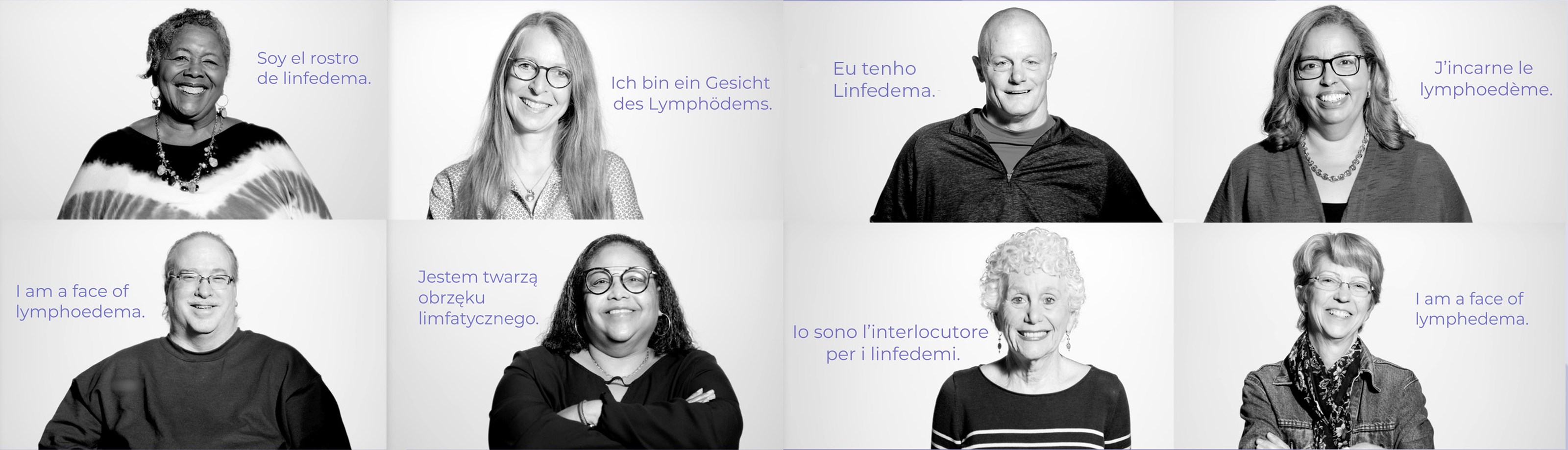 O Linfedema tem muitos rostos