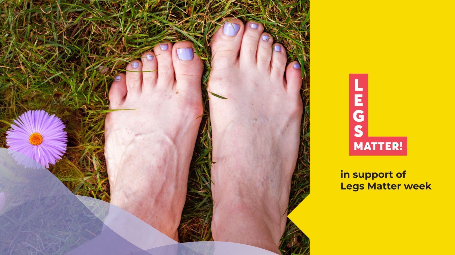 It doesn’t have to be this way: Smarter moisture management for better legs