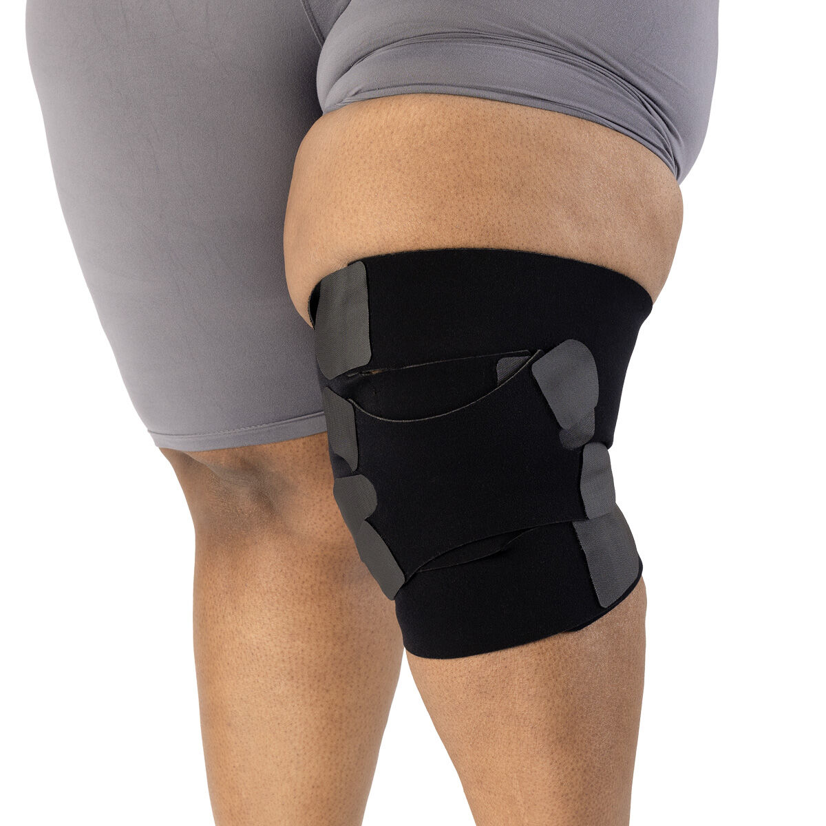 Lipedema | Sigvaris.com